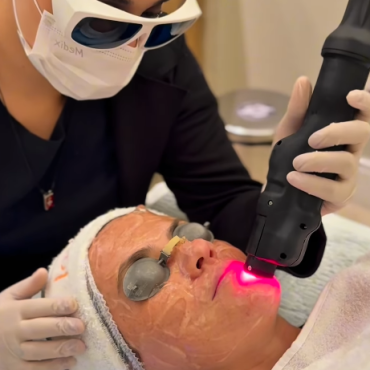 Protocolo Skin Revive com laser RedTouch Light na Jovialité Estética em Londrina